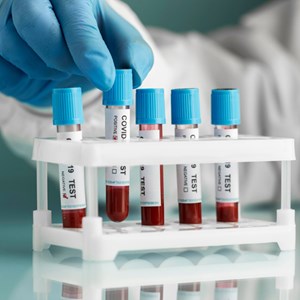 Blood test image